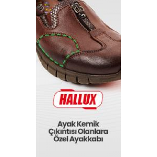 FORELLİ MOLY 25157 KEMİK ÇIKINTISI ORTOPEDİK DERİ KADIN BOT